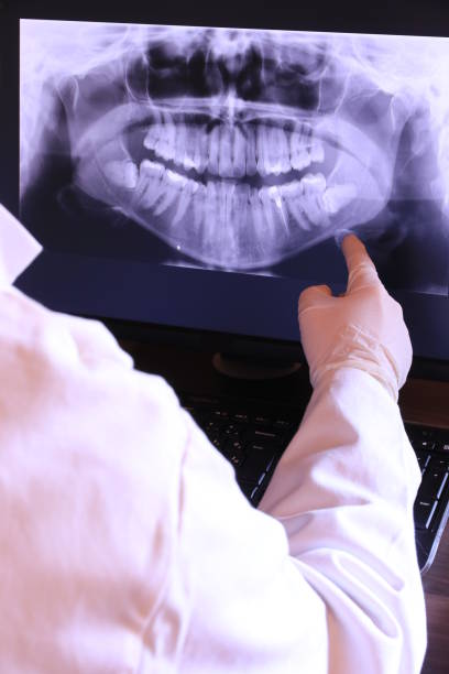 Best Emergency Tooth Extraction  in Marin City, CA