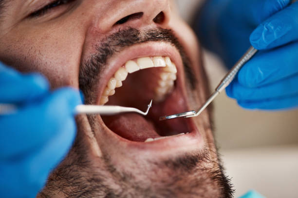 Best Cracked Tooth Emergency Dentist  in Marin City, CA