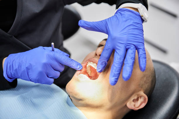 Best Emergency Gum Pain Relief  in Marin City, CA
