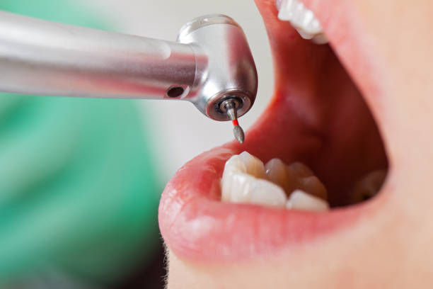 Best Same-Day Dentist Appointment  in Marin City, CA